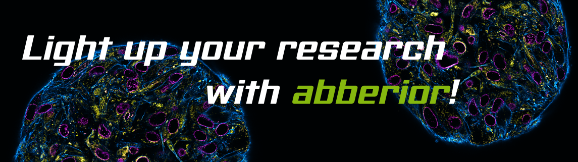 Spheroids stained with abberior secondary antibodies
