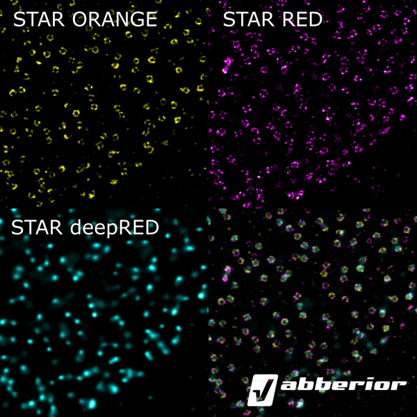 STARdeepRED-S
